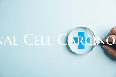 Renal Cell Carcinoma